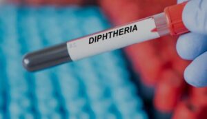Diphtheria: bring back face mask –FG urges affected states as cases soared to 8,406